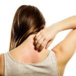 Health problem. Young woman scratching her itchy back with allergy rash
